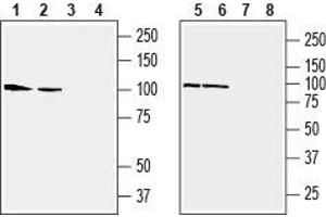 Western blot analysis of rat (lanes 1 and 3) and mouse (lanes 2 and 4) brain membranes, human SH-SY5Y neuroblastoma cell line (lanes 5 and 7) and human Jurkat T-cell leukemia cell line (lanes 6 and 8) lysates:1,2.
