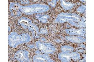 IHC analysis of FN1 using anti-FN1 antibody (ABIN7603470). (Fibronectin 1 anticorps)