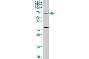 SRF monoclonal antibody (M02), clone 1C8. (SRF anticorps  (AA 406-508))