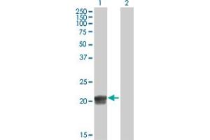 Western Blot analysis of RGS5 expression in transfected 293T cell line by RGS5 MaxPab polyclonal antibody. (RGS5 anticorps  (AA 1-181))