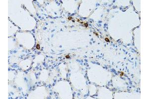 Immunohistochemistry of paraffin-embedded rat lung using TEFM antibody (ABIN5974873) at dilution of 1/100 (40x lens). (TEFM anticorps)
