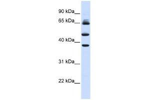 FBXL3 antibody used at 1 ug/ml to detect target protein. (FBXL3 anticorps  (Middle Region))