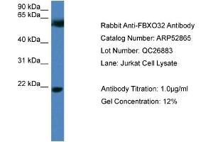 WB Suggested Anti-FBXO32  Antibody Titration: 0.