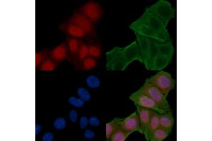ABIN6258775 and ABIN6274251 staining Hela cells(24h of starvation treatment) by IF/ICC. (ETV6 anticorps  (Internal Region))