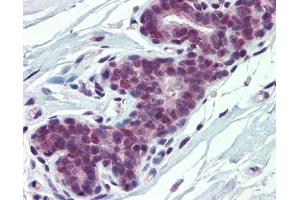 PCBP1 antibody was used for immunohistochemistry at a concentration of 4-8 ug/ml. (PCBP1 anticorps)