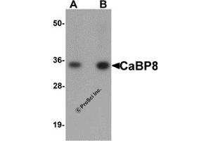 Western Blotting (WB) image for anti-Calneuron 1 (CALN1) (N-Term) antibody (ABIN1031288)