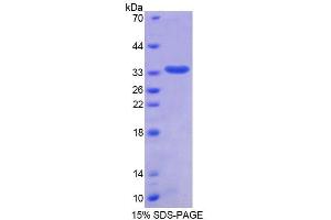 SDS-PAGE analysis of Human TMPO Protein. (Thymopoietin Protein (TMPO))