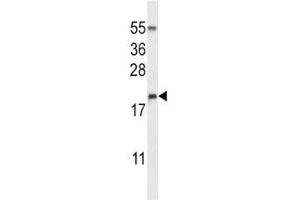 DROSHA antibody western blot analysis in NCI-H460 lysate (DROSHA anticorps  (AA 124-151))