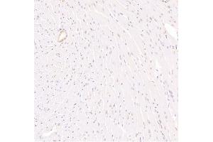 Immunohistochemistry analysis of paraffin embedded mouse heart using Zfpm2 (ABIN7076277) at dilution of 1: 3600