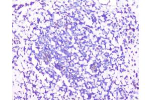 IHC analysis of RPS3 using anti-RPS3 antibody (ABIN6719371).