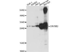 Western blot analysis of extracts of various cell lines,ing CRYBB2 antibody (ABIN5969861) at 1/1000 dilution. (CRYbB2 anticorps)