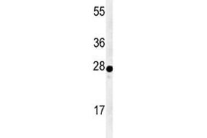 Western blot analysis of AANAT antibody and human Y79 lysate. (AANAT anticorps  (AA 27-54))