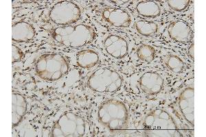 Immunoperoxidase of monoclonal antibody to MTSS1 on formalin-fixed paraffin-embedded human colon.
