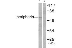 Western blot analysis of extracts from HepG2 cells, using Peripherin antibody (ABIN5976490). (Peripherin anticorps  (C-Term))