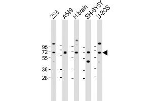 All lanes : Anti-DLL3 Antibody (C-term) at 1:2000 dilution Lane 1: 293 whole cell lysate Lane 2: A549 whole cell lysate Lane 3: Human brain lysate Lane 4: SH-SY5Y whole cell lysate Lane 5: U-2OS whole cell lysate Lysates/proteins at 20 μg per lane.