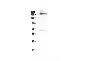 Western blot analysis of Dnmt1 using anti-Dnmt1 antibody . (DNMT1 anticorps  (AA 22-126))