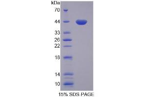SDS-PAGE analysis of Rat GTF3A Protein. (GTF3A Protéine)
