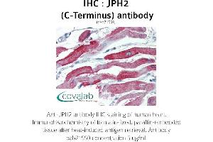 Image no. 1 for anti-Junctophilin 2 (JPH2) (C-Term) antibody (ABIN1736131) (Junctophilin 2 anticorps  (C-Term))