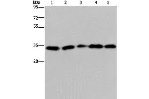 Western Blot analysis of Hela cell, Jurkat cell and Human placenta tissue, Human testis tissue and 231 cell using OCIAD1 Polyclonal Antibody at dilution of 1:200