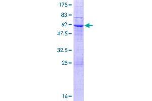 Image no. 1 for Leucine Rich Repeat Containing 10 (LRRC10) (AA 1-277) protein (GST tag) (ABIN1309742)