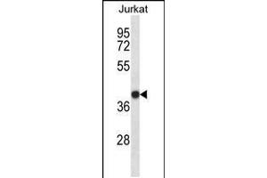 Western blot analysis in Jurkat cell line lysates (35ug/lane).