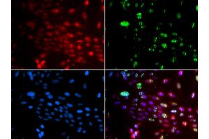 Immunofluorescence analysis of GFP-RNF168 transgenic U2OS cells using L3MBTL1 antibody (ABIN5974264). (L3MBTL1 anticorps)