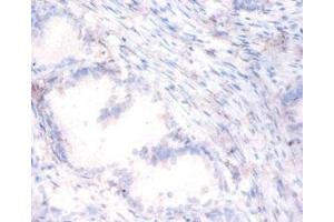 Immunohistochemistry of paraffin-embedded human prostate tissue using ABIN7169381 at dilution of 1:100 (PON1 anticorps  (AA 2-355))