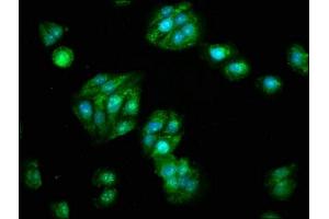 Immunofluorescence staining of HepG2 cells with ABIN7170921 at 1:133, counter-stained with DAPI.