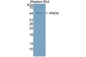Western blot analysis of the recombinant protein. (Desmoglein 2 anticorps  (AA 275-533))