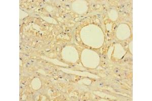 Immunohistochemistry of paraffin-embedded human skin tissue using ABIN7142622 at dilution of 1:100 (HTR2A anticorps  (AA 385-471))