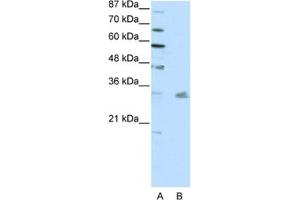 Western Blotting (WB) image for anti-Pituitary Homeobox 3 (PITX3) antibody (ABIN2461738) (PITX3 anticorps)