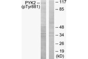 Western blot analysis of extracts from mouse brain, using PYK2 (Phospho-Tyr881) Antibody. (PTK2B anticorps  (pTyr881))