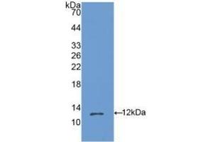 Detection of Recombinant OSM, Mouse using Polyclonal Antibody to Oncostatin M (OSM)