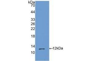 Detection of Recombinant OSM, Mouse using Polyclonal Antibody to Oncostatin M (OSM) (Oncostatin M anticorps  (AA 25-115))