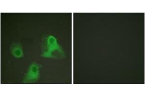 Immunofluorescence analysis of HeLa cells, using ADD1 (Phospho-Ser726) Antibody. (alpha Adducin anticorps  (pSer726))
