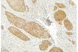 ABIN6262205 and ABIN6272919 at 1/100 staining Human normal tissues adjacent to esophageal cancer by IHC-P. (HEPACAM anticorps  (C-Term))