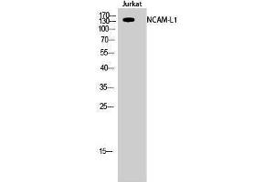 Western Blotting (WB) image for anti-L1 Cell Adhesion Molecule (L1CAM) (Ser727) antibody (ABIN3185776)