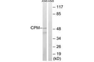 Western blot analysis of extracts from A549 cells, using CPM Antibody. (CPM anticorps  (AA 71-120))