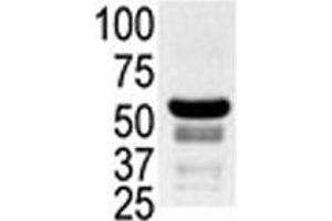 Western blot testing of ovary lysate with PAK2 antibody.