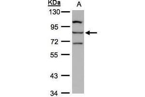 WB Image Sample(30 ug whole cell lysate) A:Hep G2 , 7. (ALOXE3 anticorps)