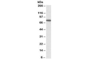 Western blot testing of HeLa lysate with SNX1 antibody at 1ug/ml. (Sorting Nexin 1 anticorps)