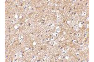 Immunohistochemical staining of human brain tissue using SP110 polyclonal antibody  at 2. (SP110 anticorps  (C-Term))