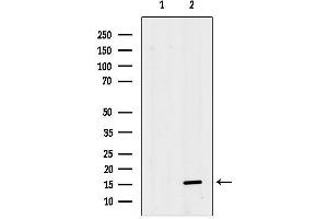 anti-Mitochondrial Ribosomal Protein S36 (MRPS36) (Internal Region) antibody
