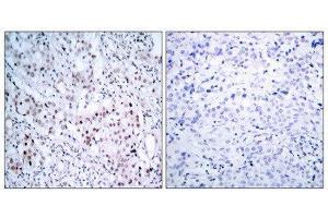 Immunohistochemistry (IHC) image for anti-Jun Proto-Oncogene (JUN) (pSer63) antibody (ABIN1847456) (C-JUN anticorps  (pSer63))