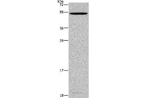 Western blot analysis of Mouse testis tissue, using CATSPER3 Polyclonal Antibody at dilution of 1:350 (CATSPER3 anticorps)