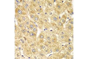 Immunohistochemistry of paraffin-embedded human liver injury using OGT antibody (ABIN4904611) at dilution of 1:100 (40x lens). (OGT anticorps)