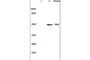 Lane 1: mouse brain lysates Lane 2: human colon carcinoma lysates probed with Anti APOJ/CLUSTERIN Polyclonal Antibody, Unconjugated (ABIN685342) at 1:200 in 4C.