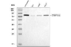 Western blot analysis of TRPV6 using anti-TRPV6 antibody (ABIN7600120).