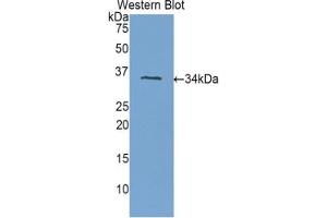 Detection of Recombinant PLXNB1, Human using Polyclonal Antibody to Plexin B1 (PLXNB1) (PLXNB1 anticorps  (AA 1780-2042))