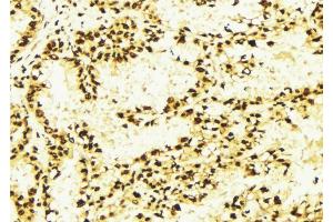 ABIN6269385 at 1/100 staining Human lung tissue by IHC-P. (HDAC2 anticorps  (Internal Region))